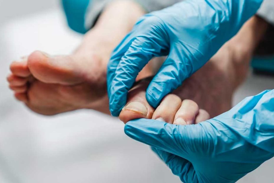 patologías del dedo del pie y podologia
