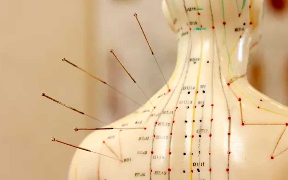 modelo anatomico de acupuntura